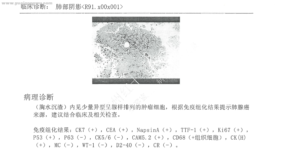 免疫组化